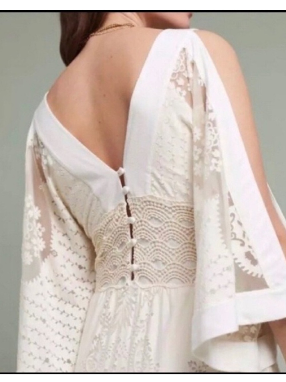 Farm Rio Solana Dress XS - Picture 2 of 5